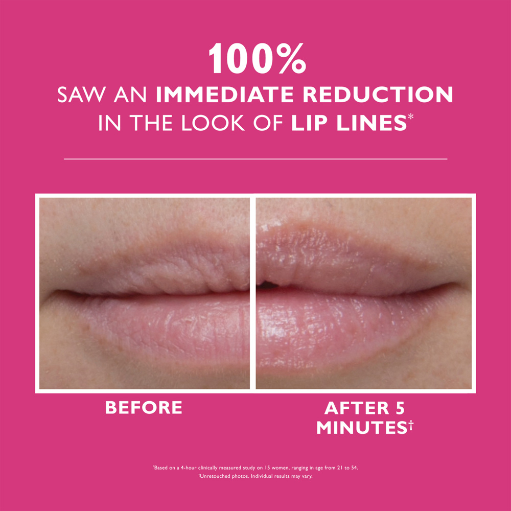 Instant FIRMx® Lip Filler