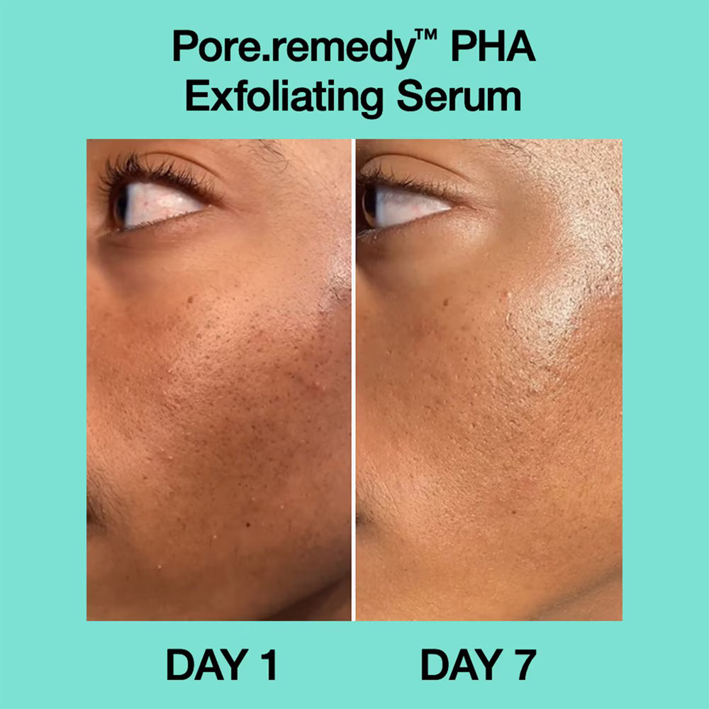 Pore·Remedy PHA Exfoliating Serum, 30ml